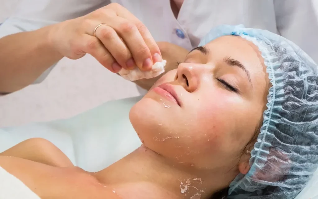 Chemical Peels for Face: How to Get Rid of Wrinkles, Acne & Dark Spots
