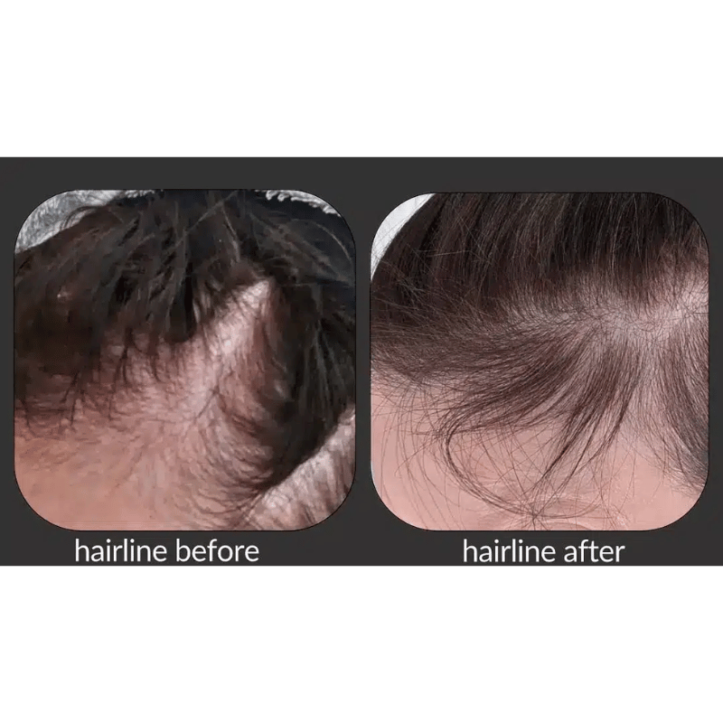 croma™ philart hair croma™ philart hair