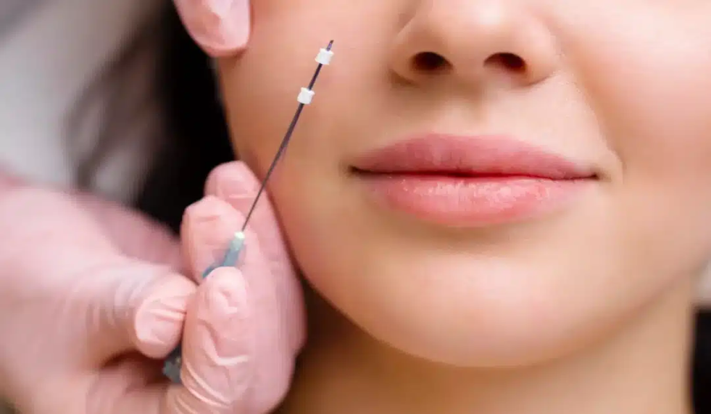 Thread Lift Recovery & Aftercare: Dos and Don’ts for Best Results