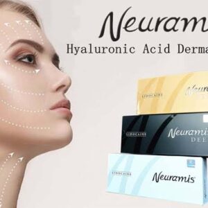 Neuramis Light Lido